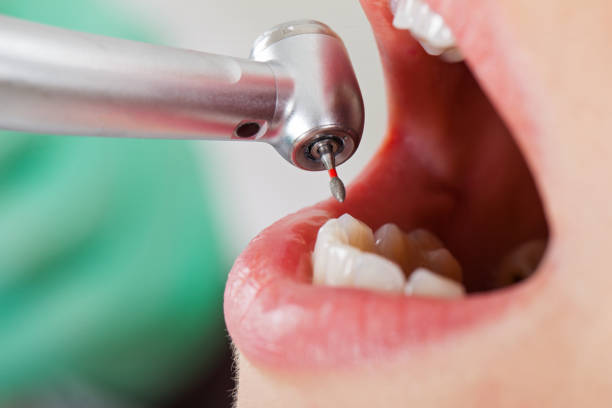 Best Walk-In Emergency Dental Services in Woodward, IA